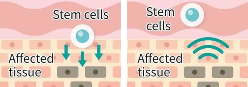 Stem cells→Affected tissue