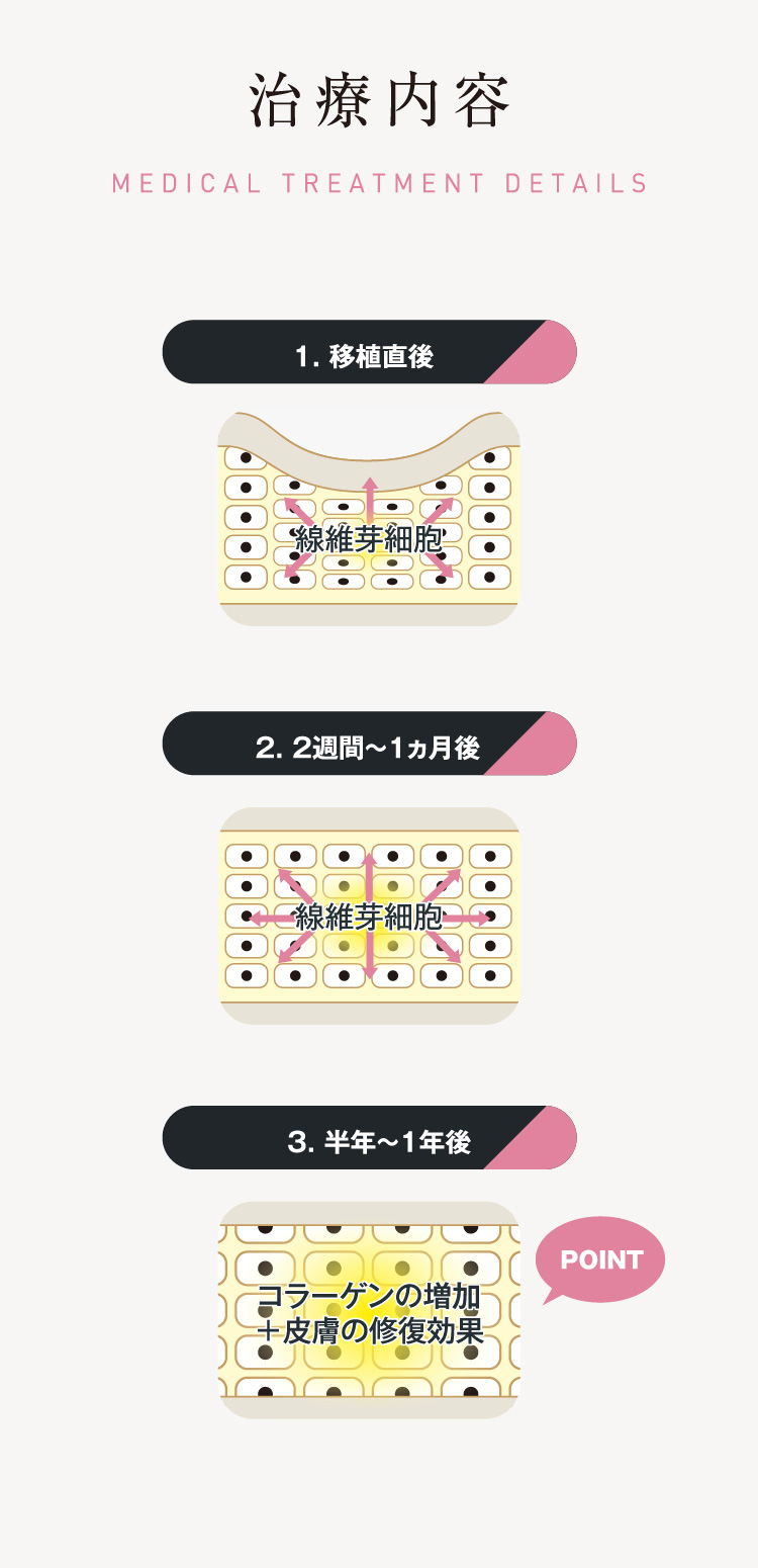 治療内容