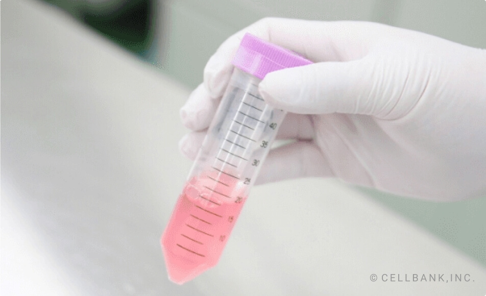 Stem Cell Therapy